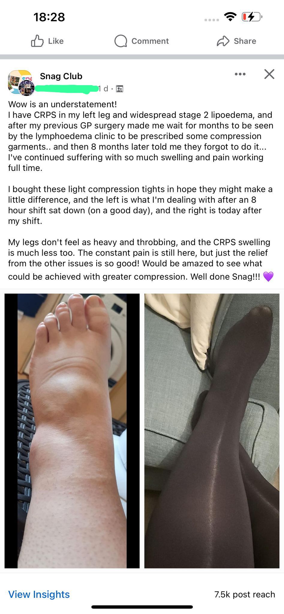 Huggy Light Compression Tights - Black